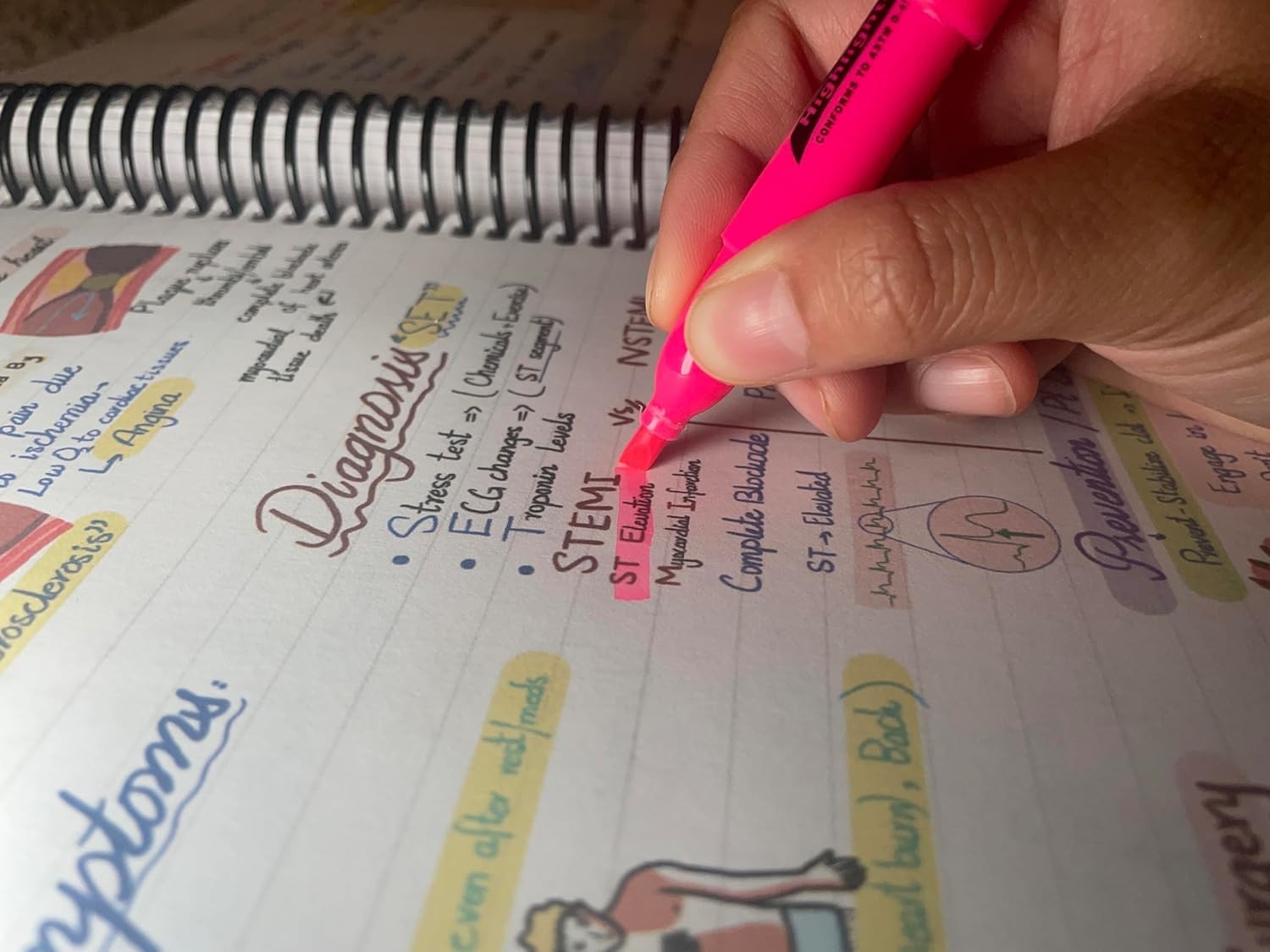 Nursing Success Bundle: 400+ Page Handwritten Notes, Designed to Ace Nursing Sch
